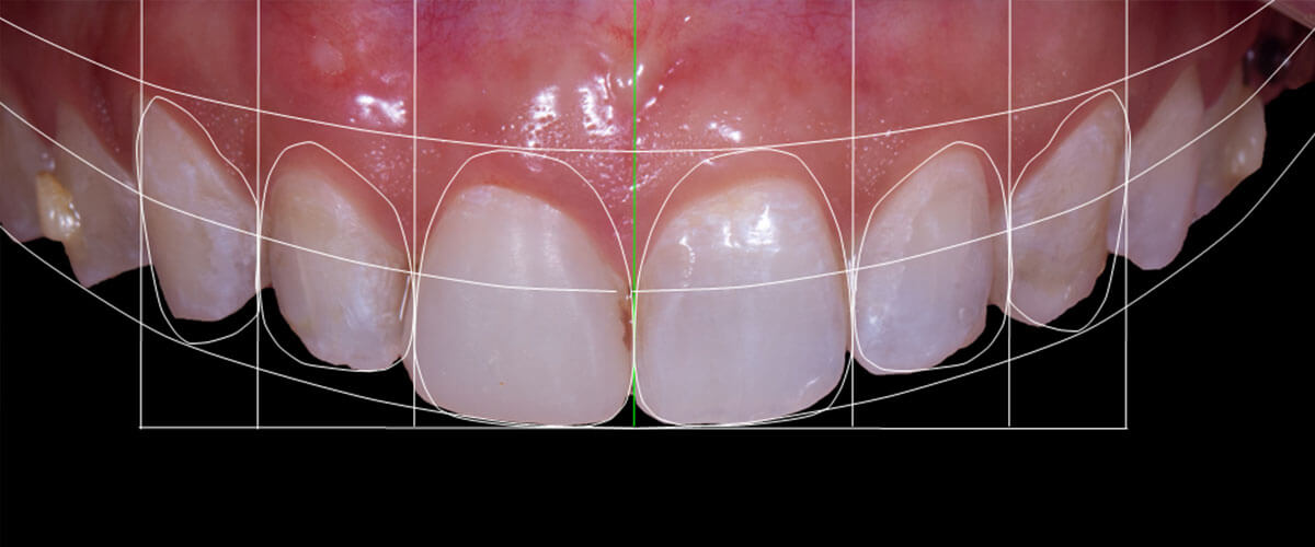 tecnologia-digital-smile