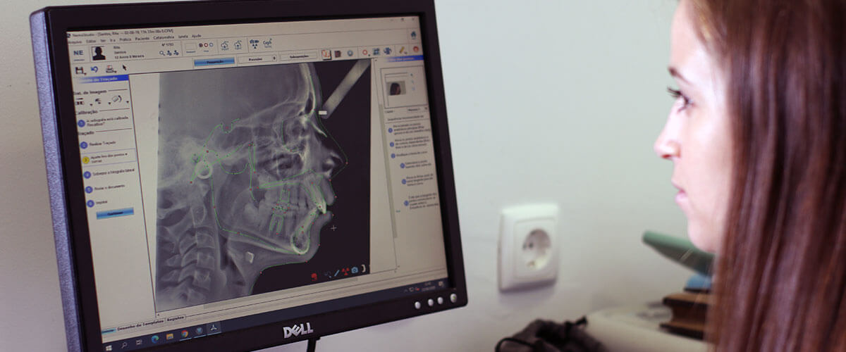 tecnologia-radiografia