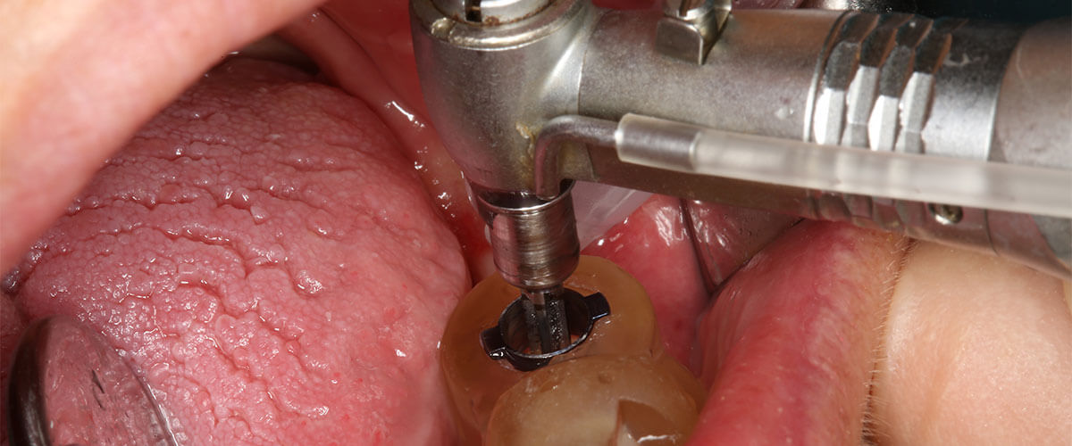 tec-cirurgia-guiada