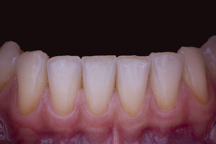 PERIODONTOLOGIA